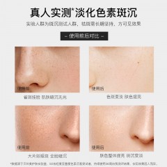贝玲美（BEILINGMEI）美白祛斑面霜男女士去斑霜中年妈妈老年人补水保湿擦抹脸油护肤品 贝玲美美白祛斑霜50g