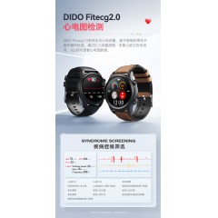 dido嘀嘟  无创血糖血氧心率血压智能手环 E55SPro 非器械 【多款颜色可选】