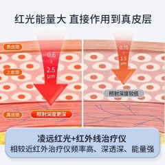 凌远立式红外线治疗仪LY-609A